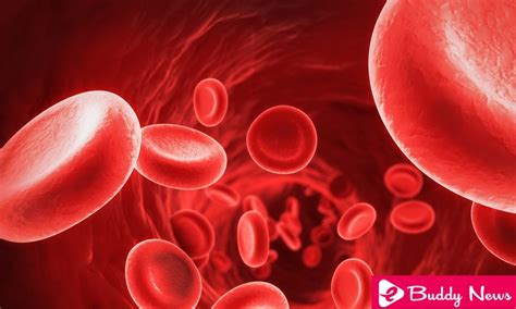 poikilocytosis symptoms|Poikilocytosis: Causes, Treatments, and More .